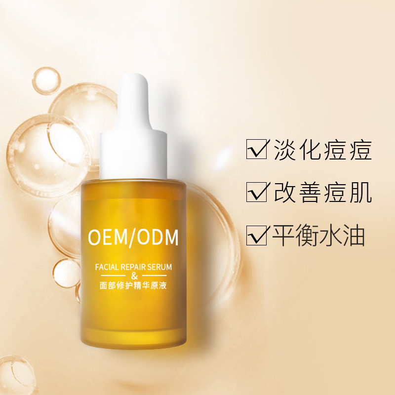 阳泉市_祛痘精华原液OEM